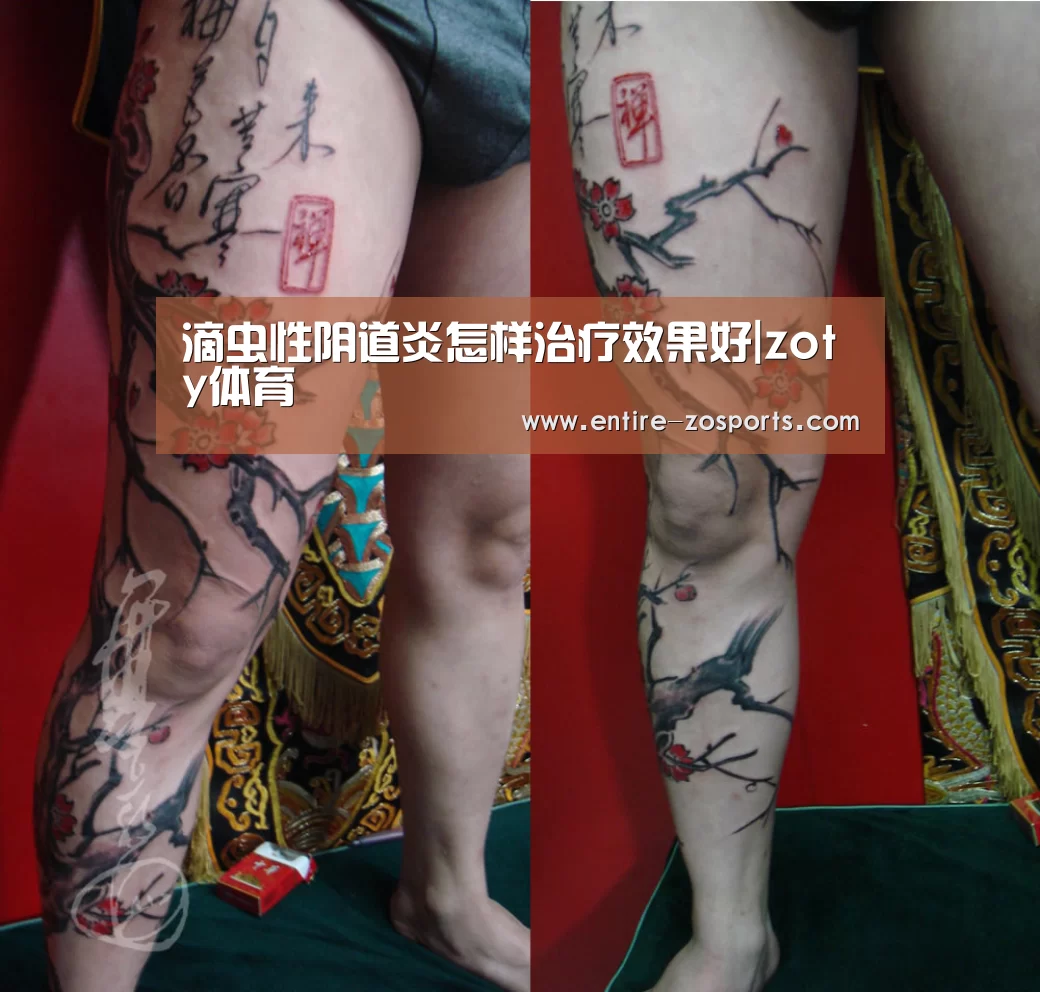 滴虫性阴道炎怎样治疗效果好|zoty体育(图4) 中欧体育
